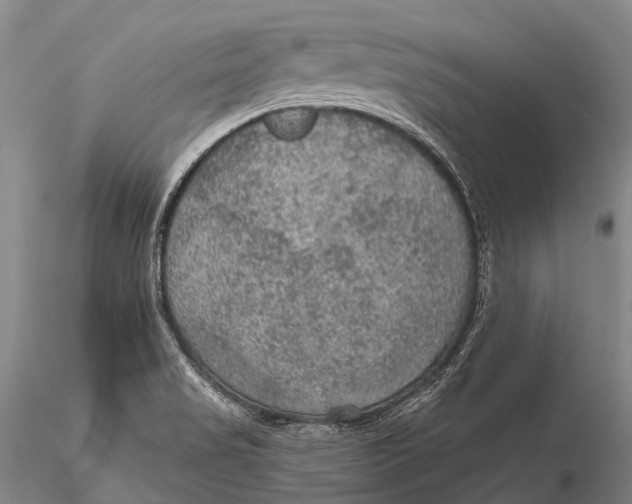 X0000115611517200912011538