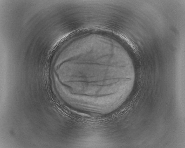 X0000115610872200912081000