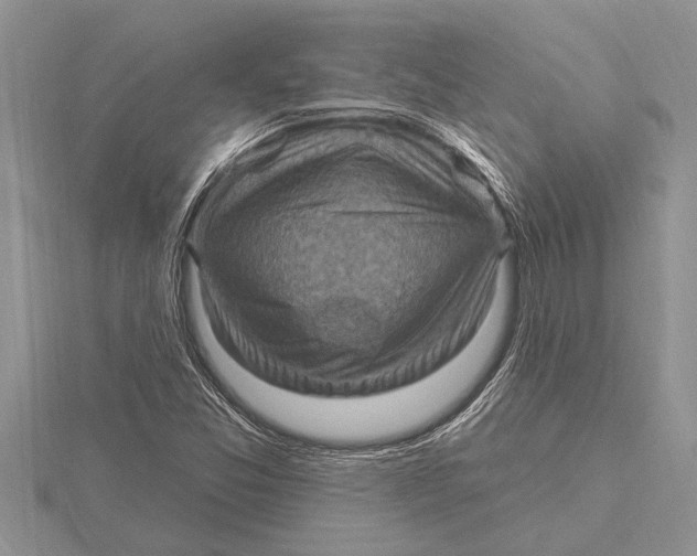 X0000115611357200912080954