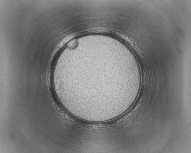 X0000115611410200912080953