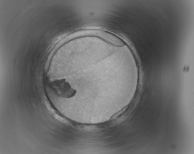 X0000115610385200912221212