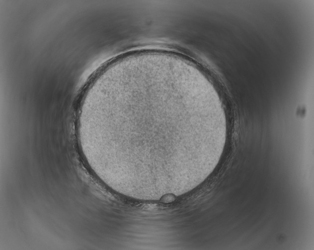 X0000115611360200912221158