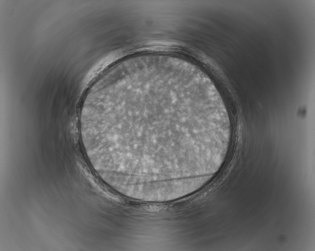 X0000115611362200912221158