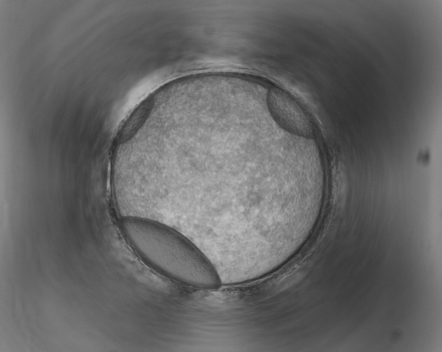 X0000115611365200912221158
