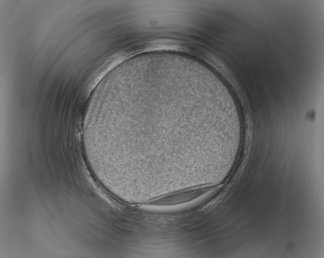 X0000115611377200912221158