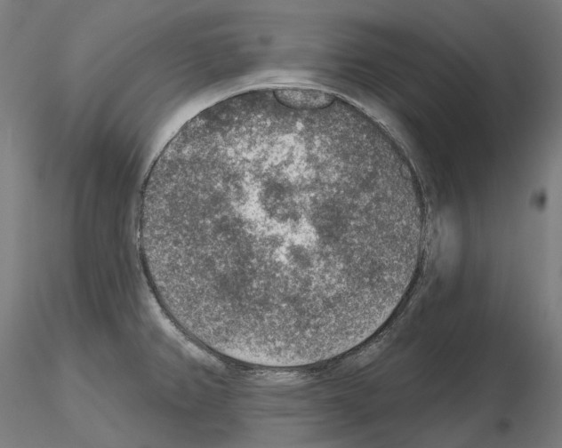 X0000115611382200912221158