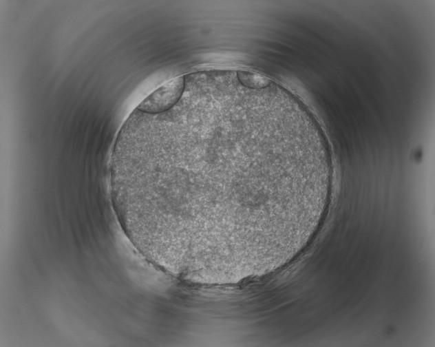 X0000115611386200912221158