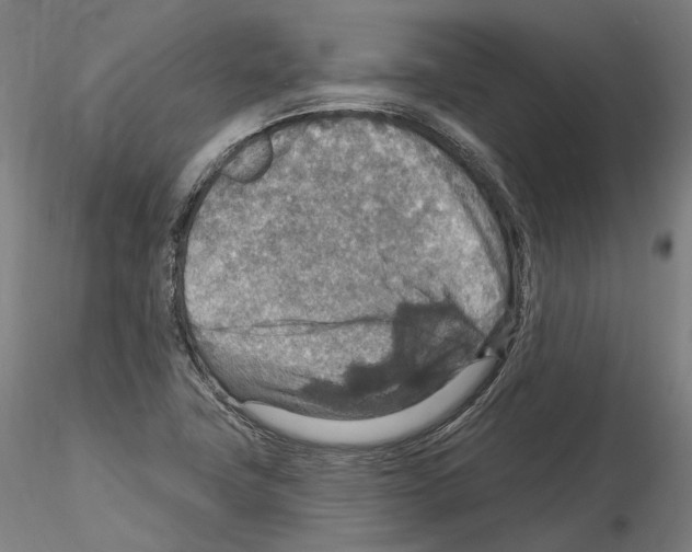 X0000115611411200912221157