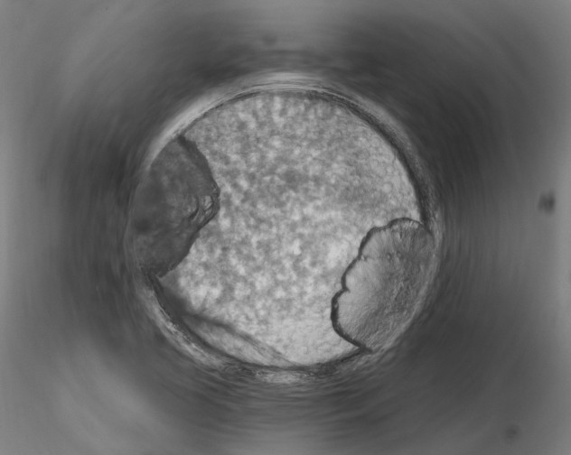 X0000115611413200912221157