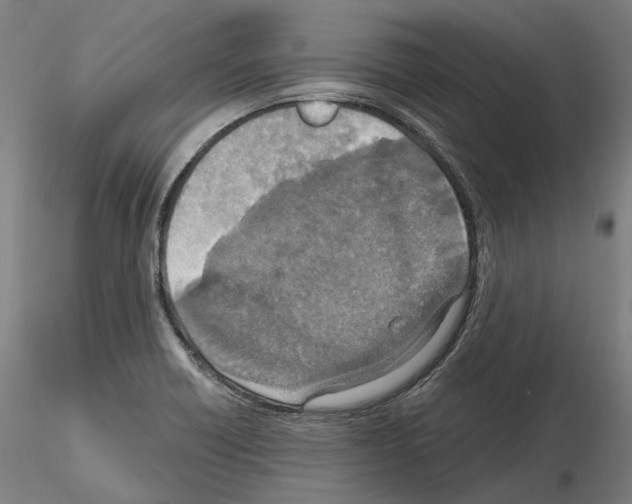 X0000115611418200912221157