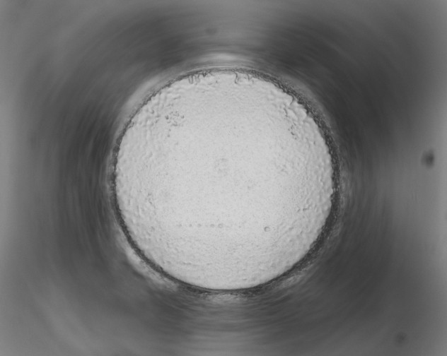 X0000115611421200912221158