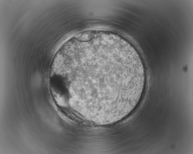 X0000115611425200912221158