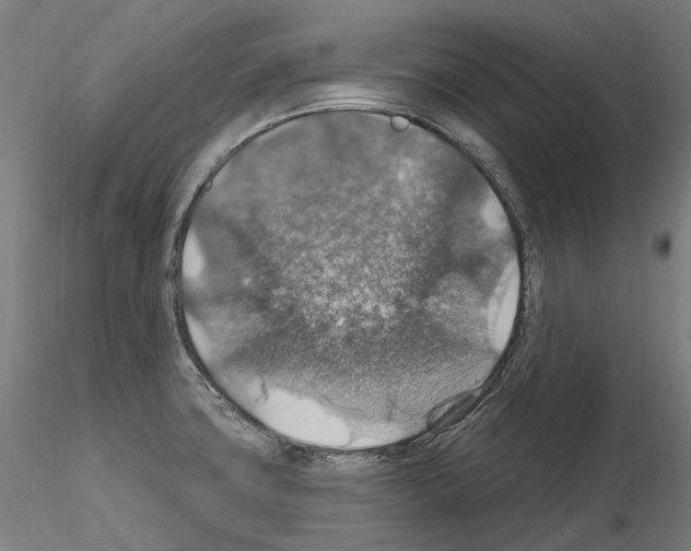 X0000115611427200912221158