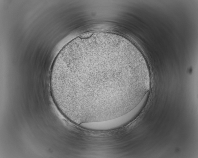 X0000115611434200912221158