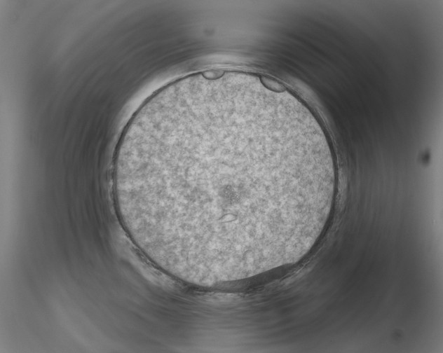 X0000115611435200912221158