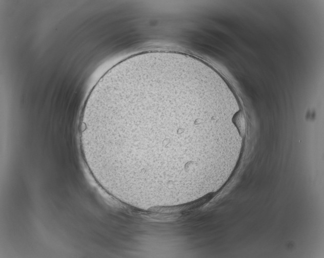 X0000115611440200912221158