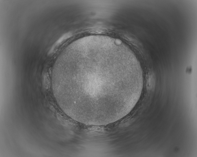 X0000115611446200912221157
