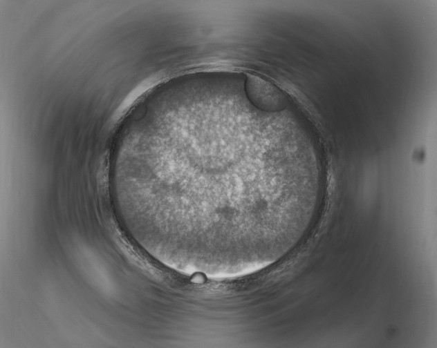 X0000115611450200912221157