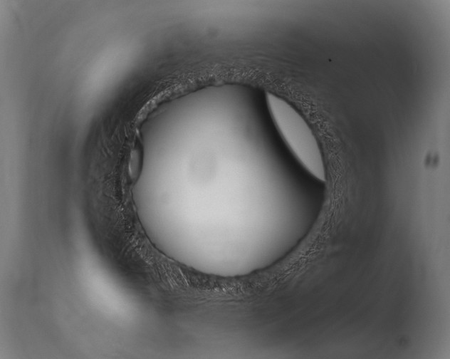 X0000115620144200911101104