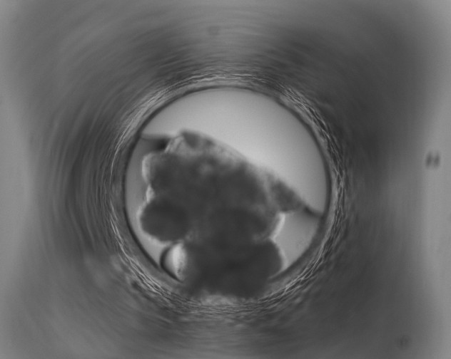 X0000115620145200911101104