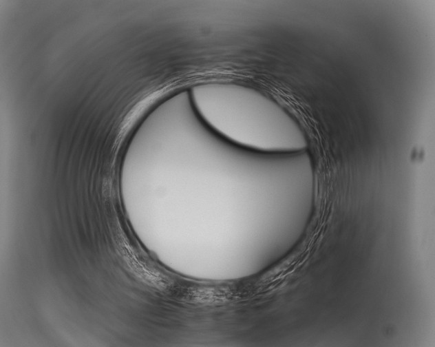 X0000115620147200911101104