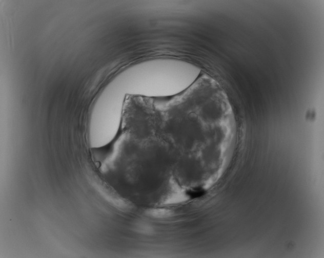 X0000115620361200911101101