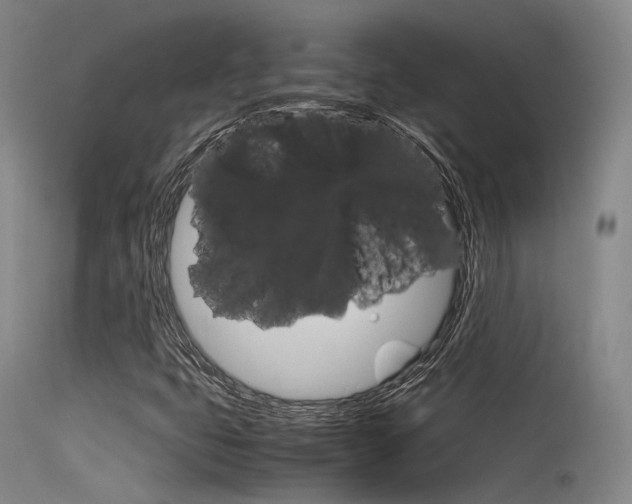 X0000115621399200911101045