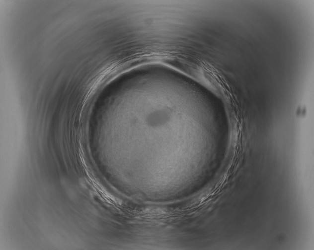 X0000115620145200911101423