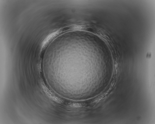 X0000115620149200911101423