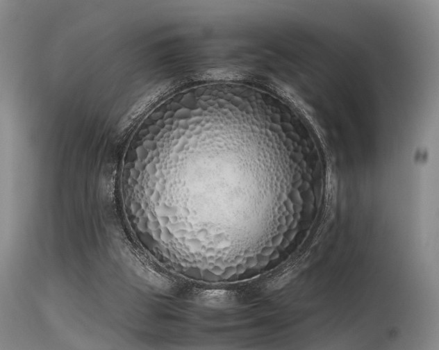 X0000115620153200911101423