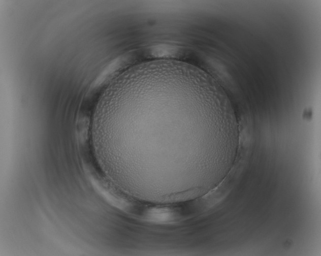 X0000115620171200911101423