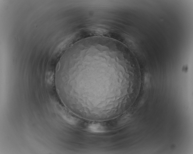 X0000115620177200911101423