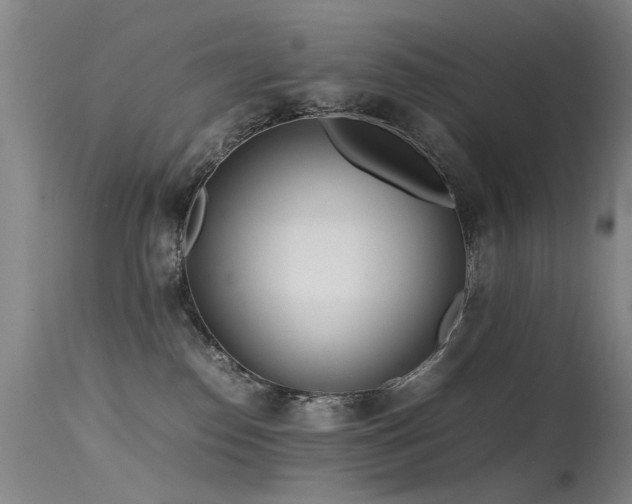 X0000115620186200911101423