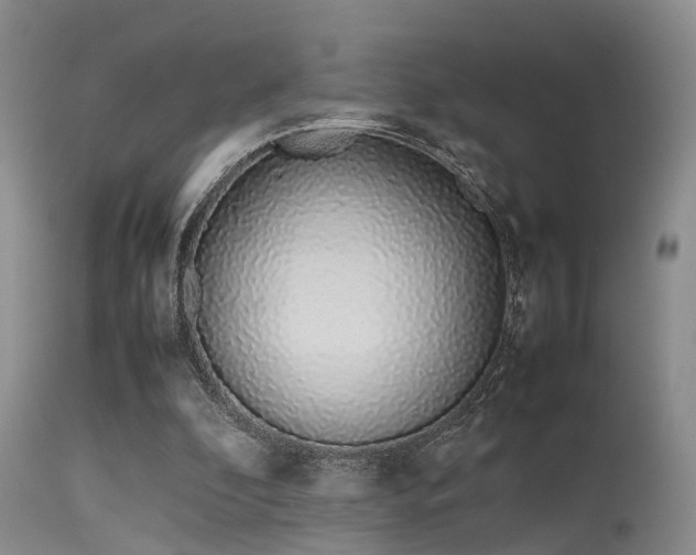 X0000115620296200911101421