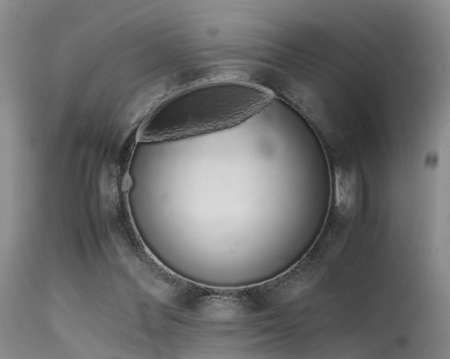 X0000115620300200911101421