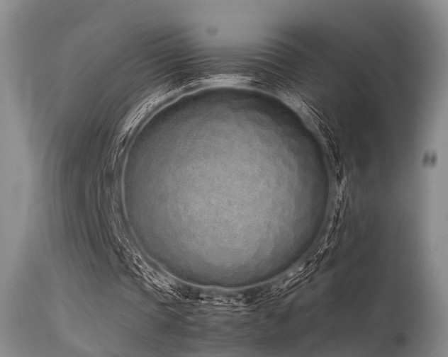 X0000115620337200911101420