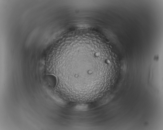 X0000115620369200911101420