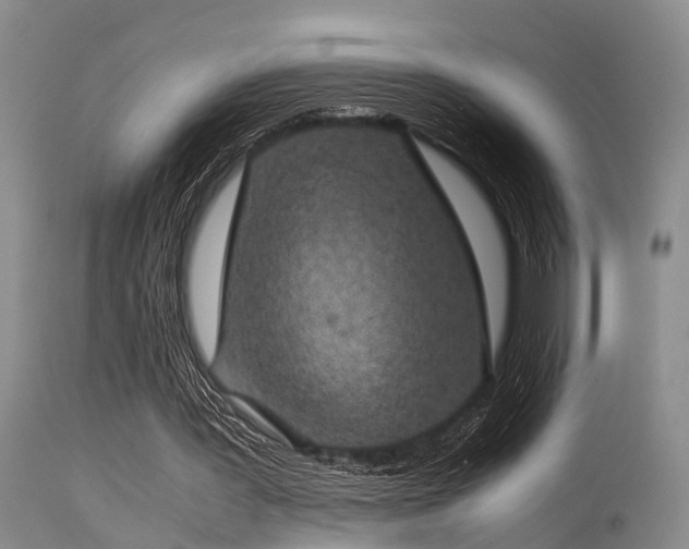 X0000115620387200911101420