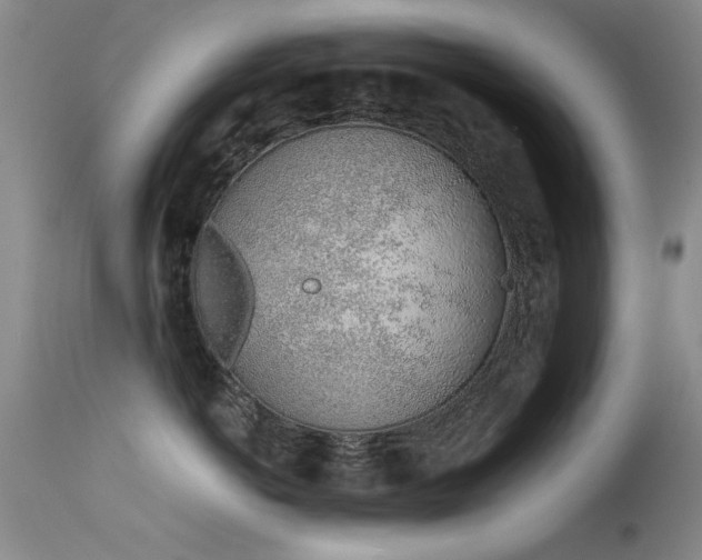 X0000115620766200911101415