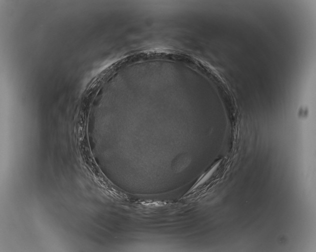 X0000115621303200911101406