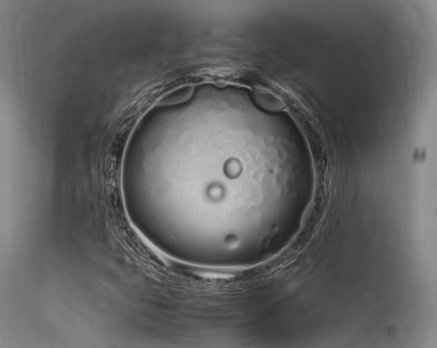 X0000115621399200911101405