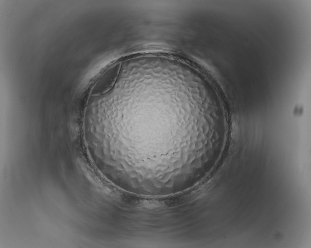 X0000115621407200911101405