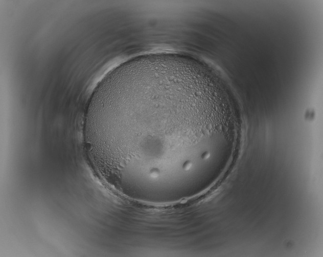 X0000115621409200911101405