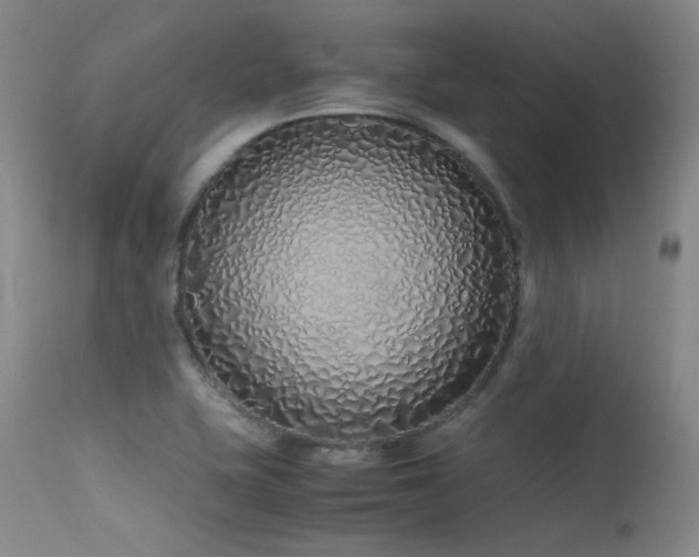 X0000115621415200911101405