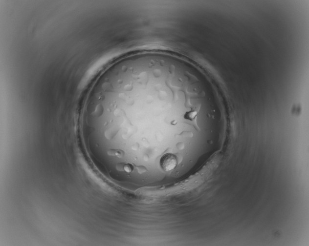 X0000115621416200911101405