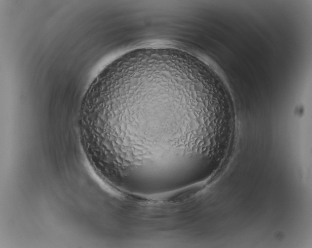 X0000115621429200911101405