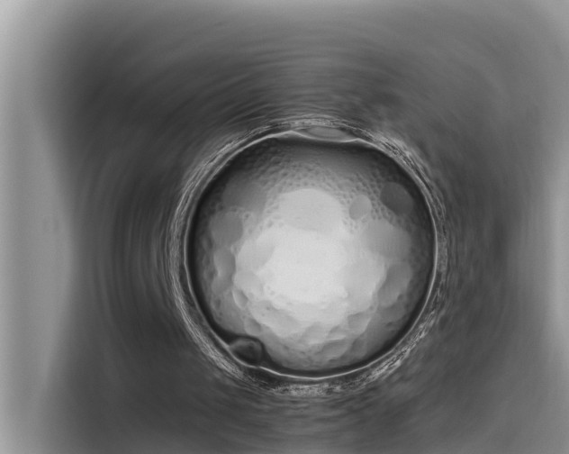 X0000115620049200911171324