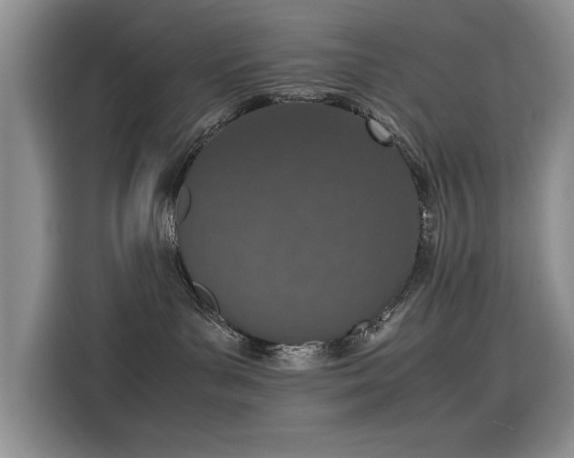 X0000115620143200911171323