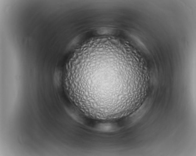 X0000115620171200911171323