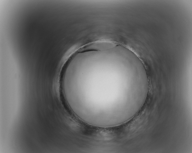 X0000115620199200911171322